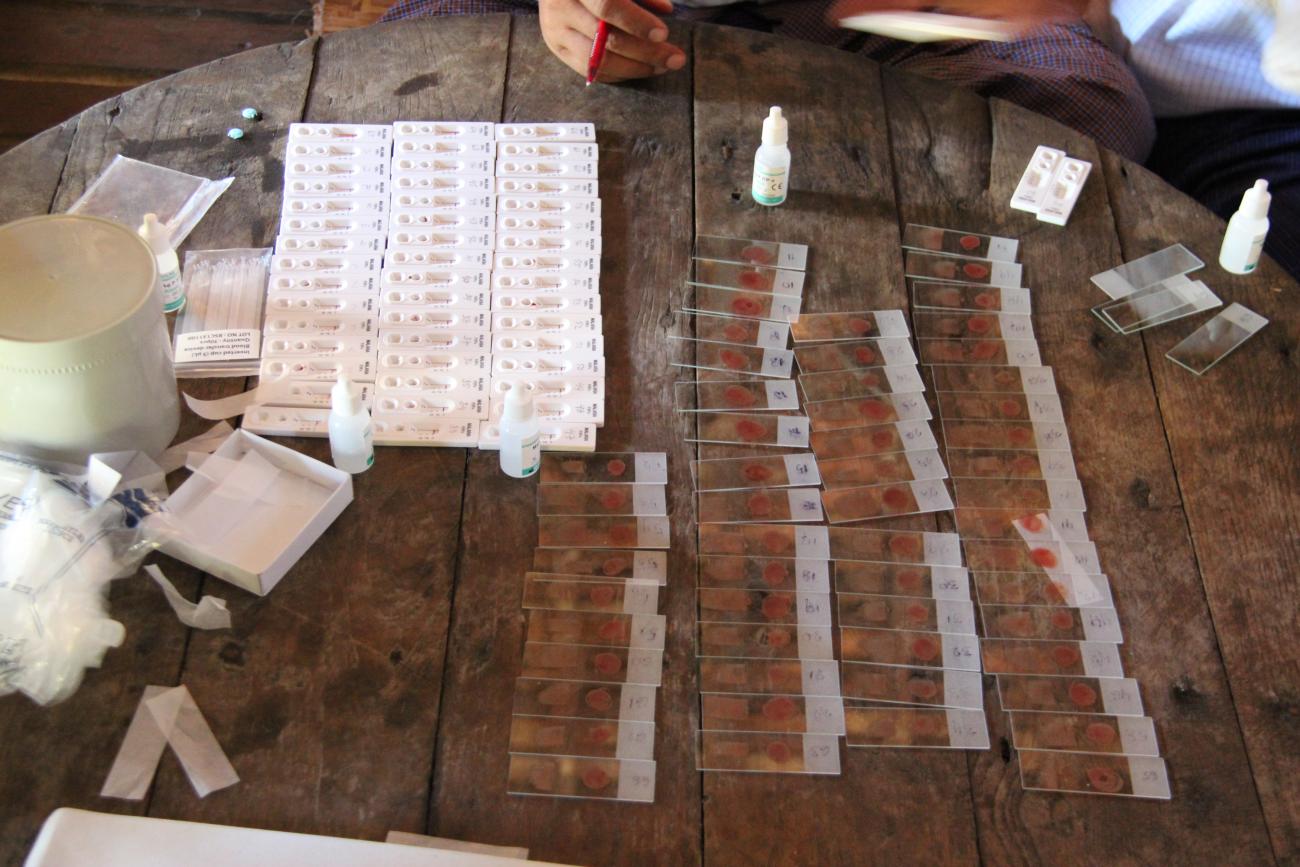 Malaria tests are seen on a table in the Ta Gay Laung village hall in Hpa-An district, Kayin State, southeastern Myanmar, on November 28, 2014.