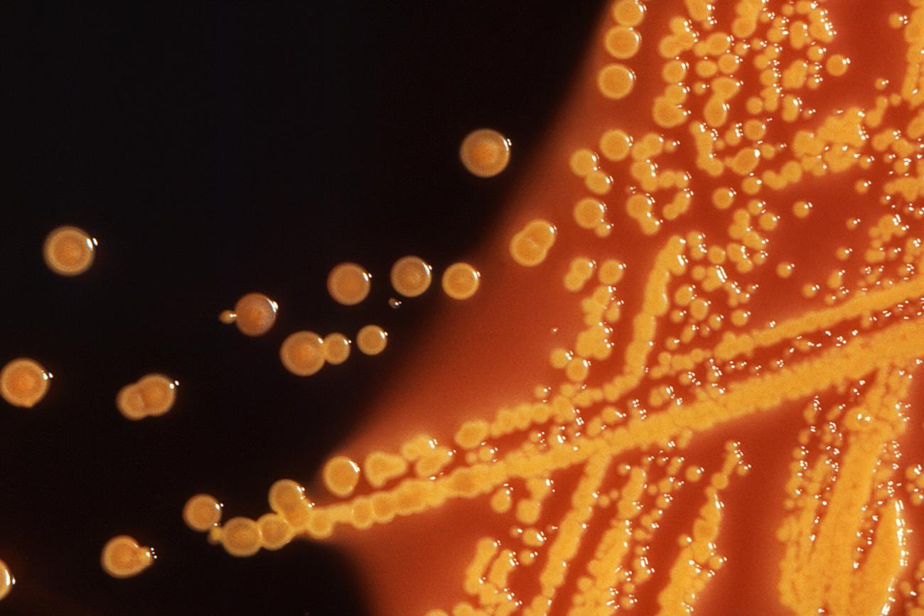 Photo shows a plate with small round dots of various size—the colonies of bacteria.