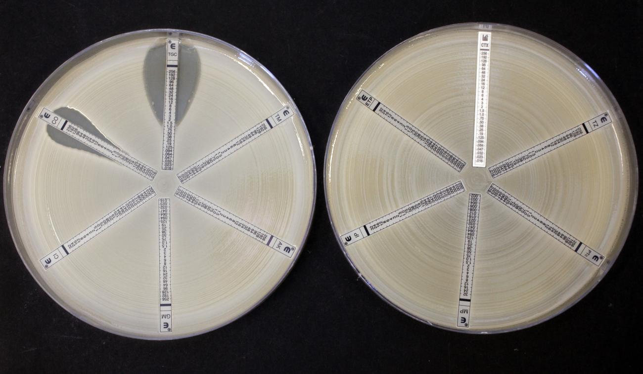 Two plates coated with Klebsiella, an antibiotic-resistant bacteria, are seen at the Health Protection Agency.