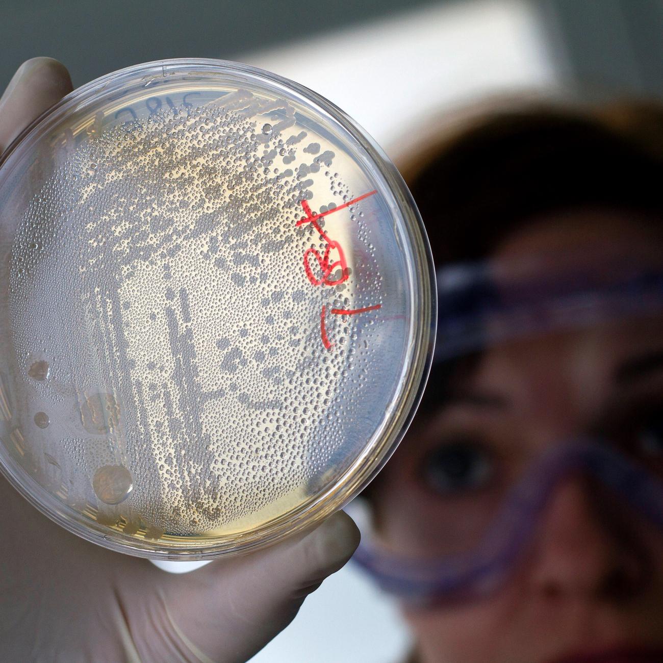 A laboratory worker looks for strains of E. coli bacteria in vegetable cells placed in a petri dish.