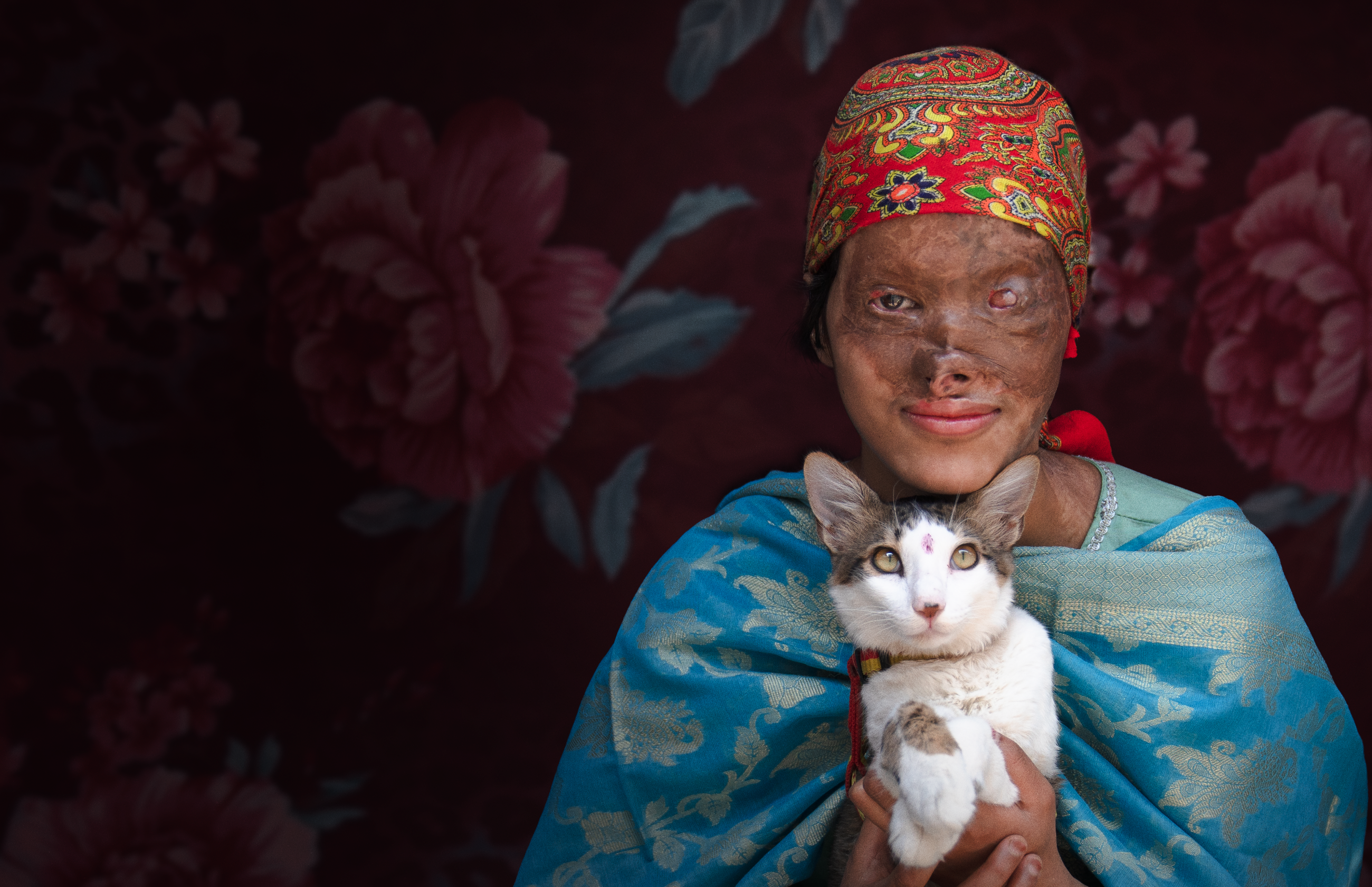 Rajkumari, a 17-year-old epilepsy and burn patient, holds her cat Whisky, in Uttarakhand, India.