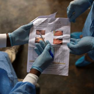 What South Africa’s Fatal Mpox Cases Mean for the Global Crisis